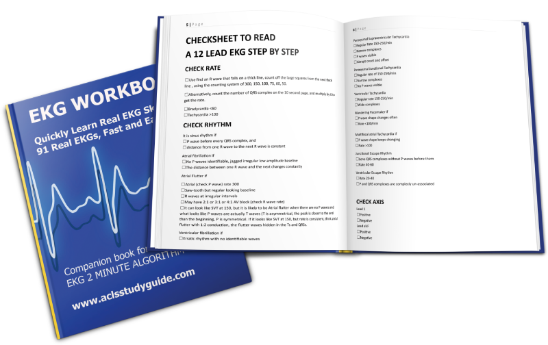 EKG Workbook 1