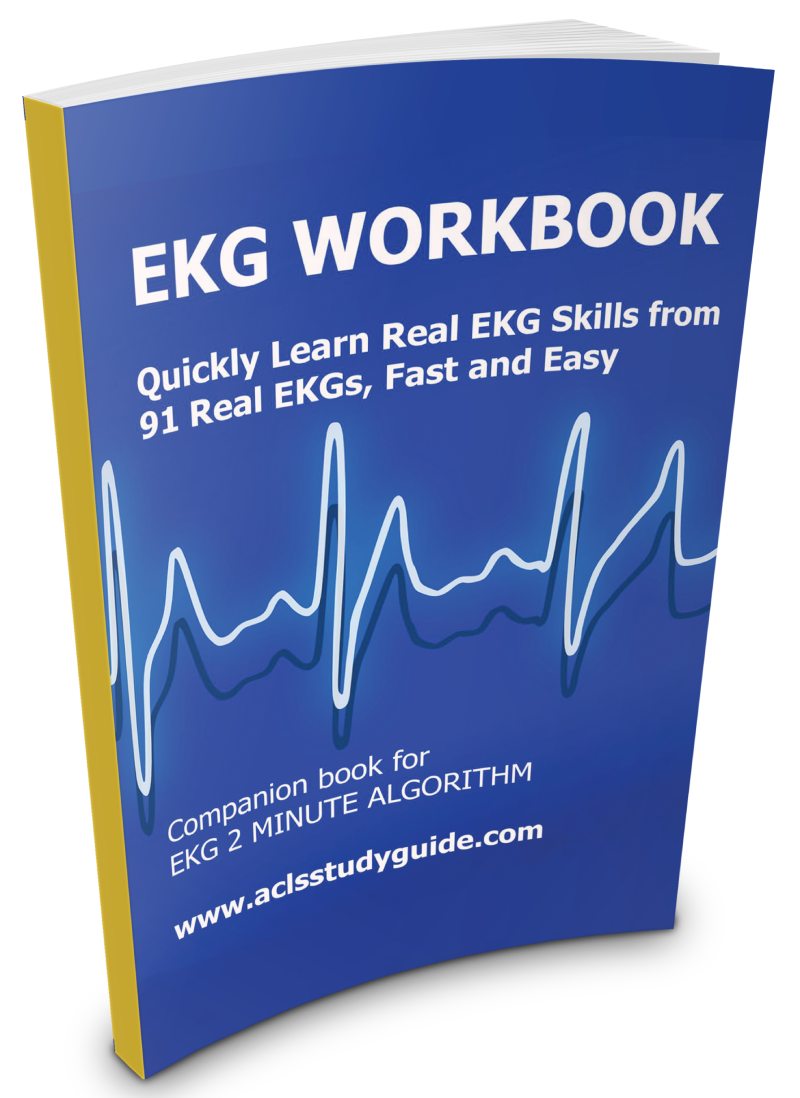 EKG Workbook 2